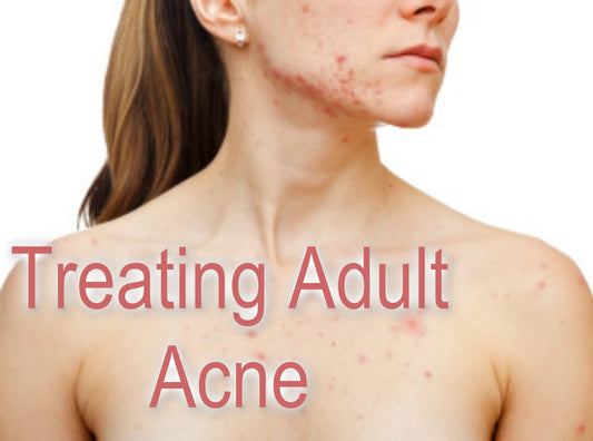 Pimples, Blemishes, Acne, What is going on?